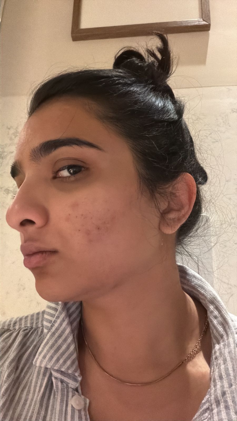 May 7 skin baseline